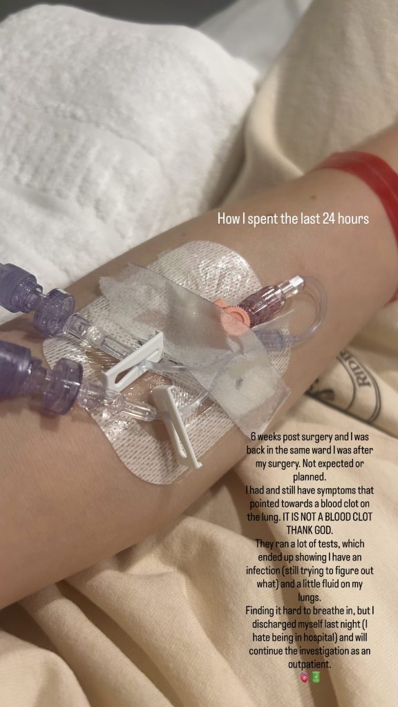 A photo of Jessie J's arm