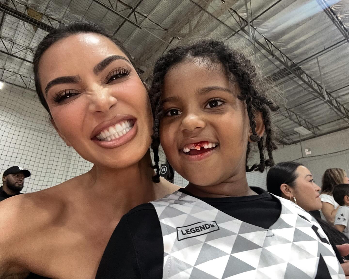 Kim Kardashian and Saint pose for a snap after he loses a tooth.