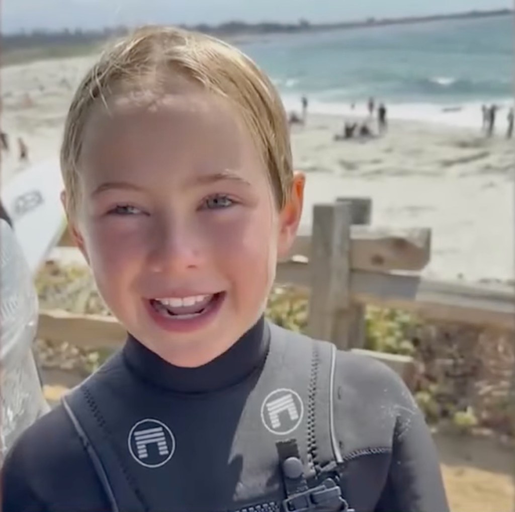 Smiling girl in wetsuit after being bitten by a sea lion.