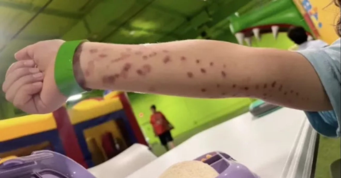 Angry Mom Blasts ‘Wild’ Octopus Attack on Son at Aquarium