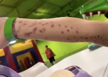 Angry Mom Blasts ‘Wild’ Octopus Attack on Son at Aquarium