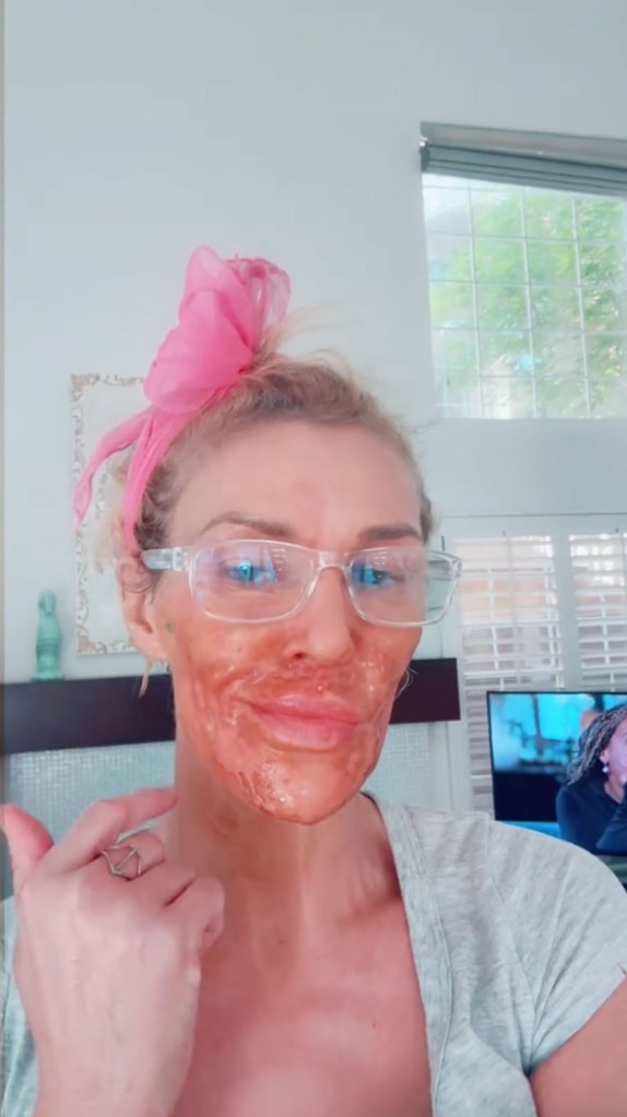 Brandi Glanville burnt from Nair