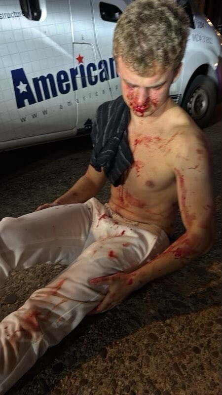 A young man covered in blood sits on the ground.
