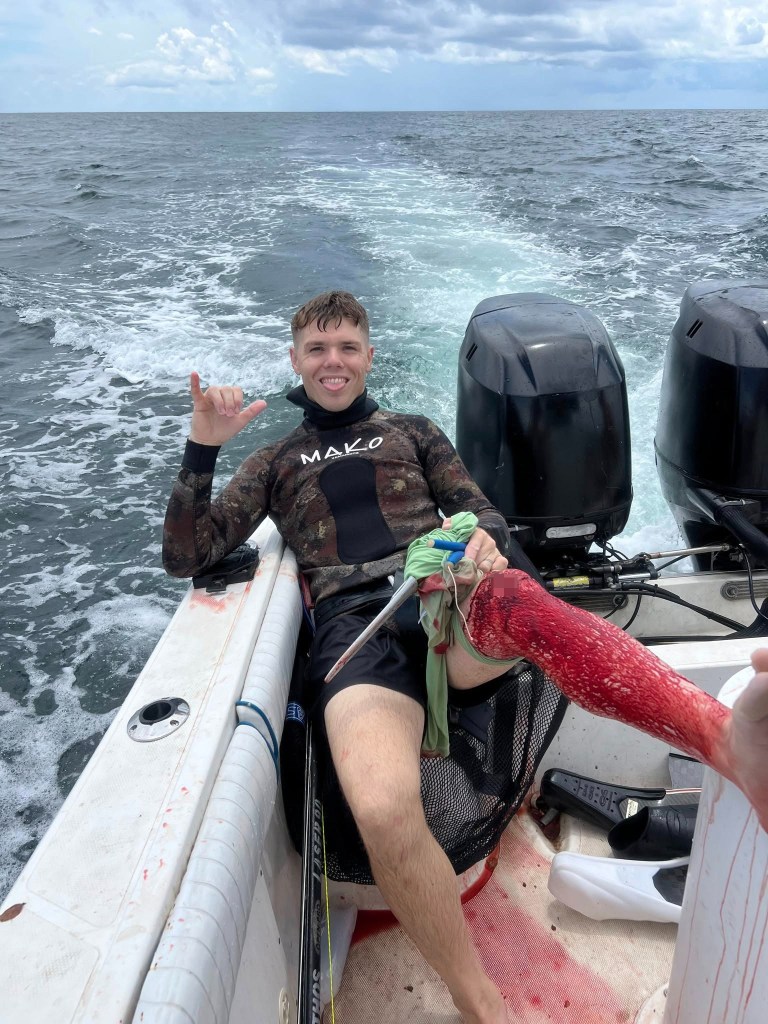 Chance Armand is seen after getting attacked by a shark while spearfishing on August 3, 2025. 