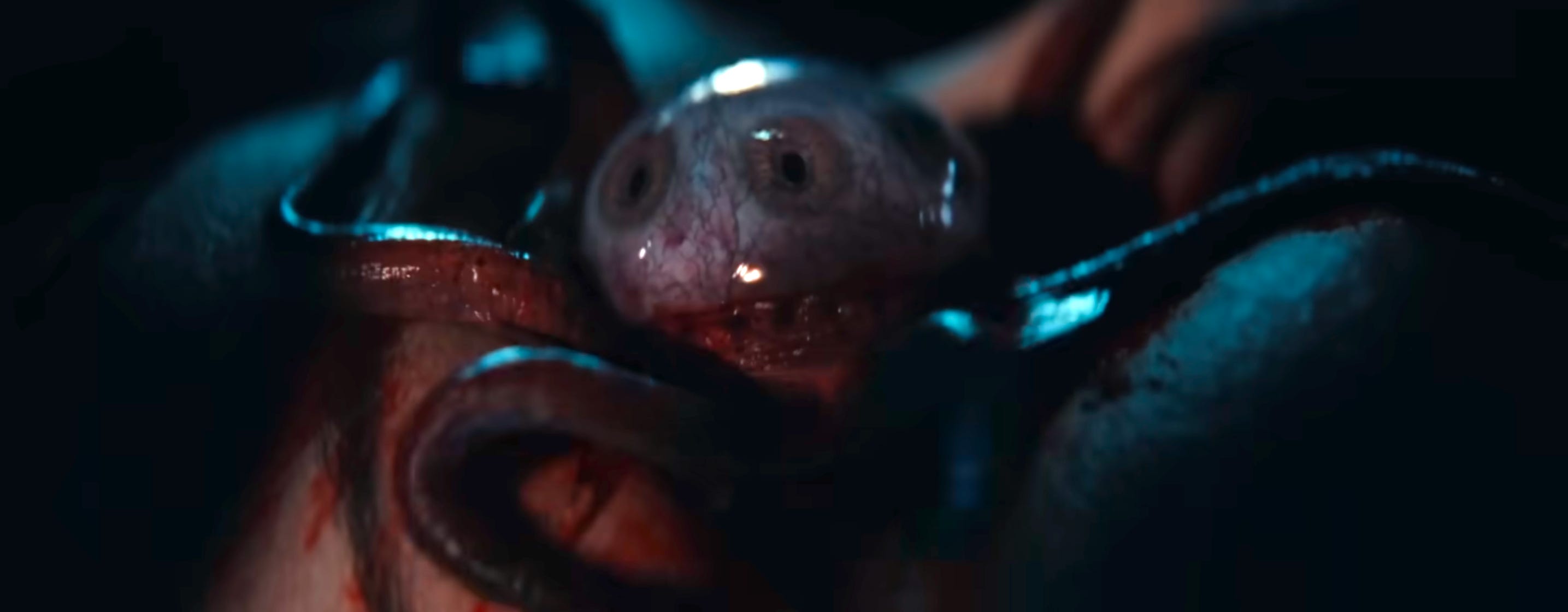 An eyeball with three different irises emerges from a wound. It has several fleshy tentacles attached at its base.