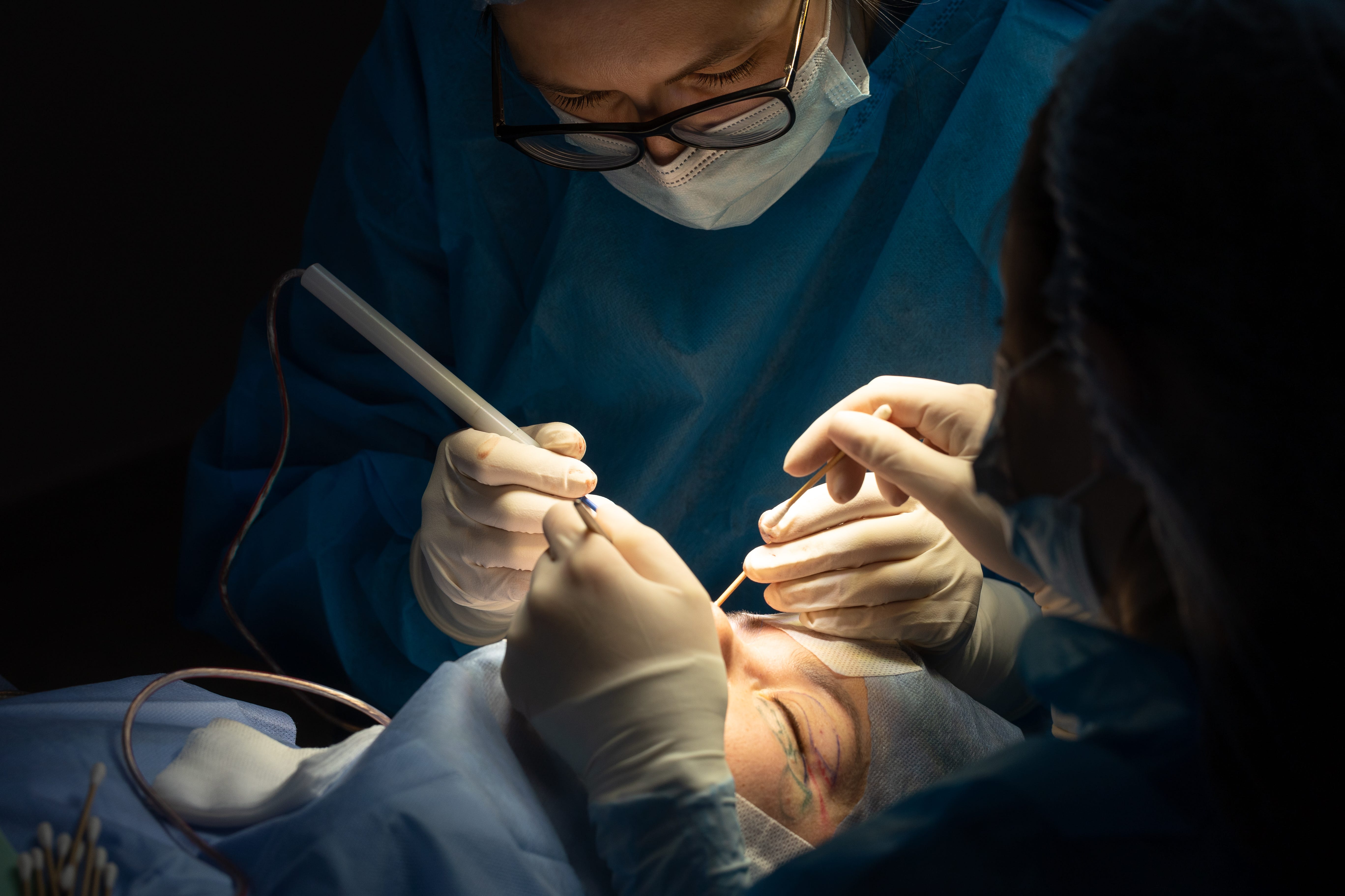 The plastic surgeon performs blepharoplasty surgery