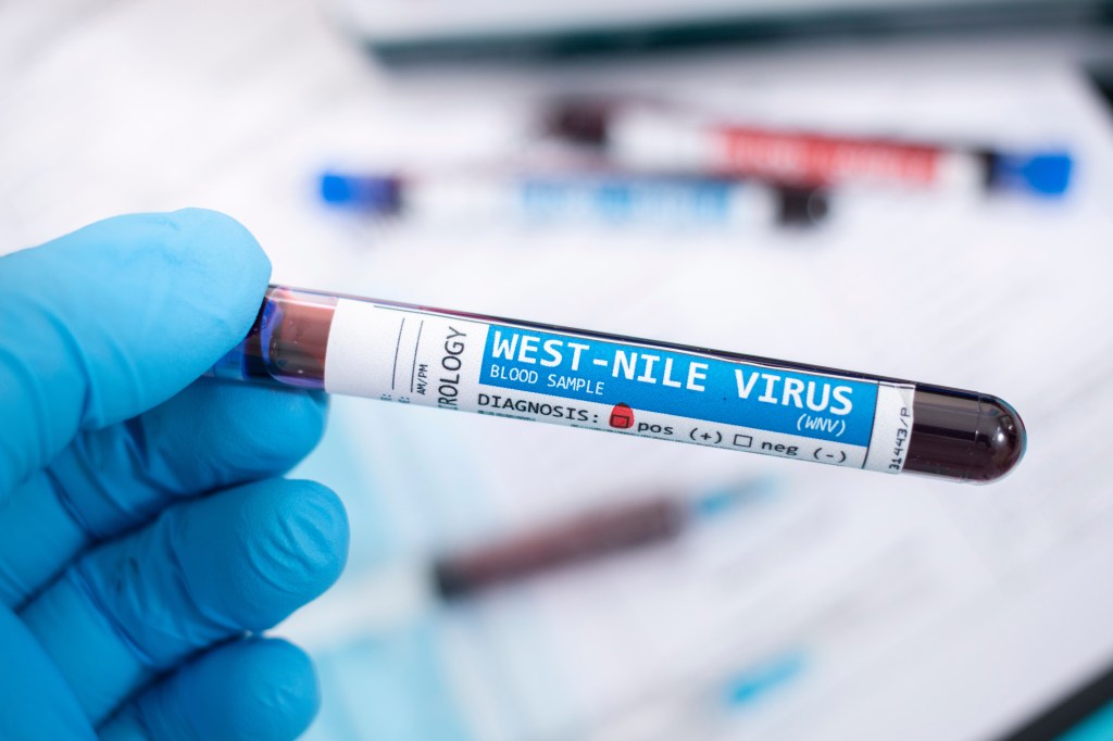 Blood sample testing positive for West Nile Virus.