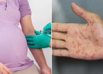 Three babies die amid ‘concerning rise’ of syphilis in New York — what to know about the dangerous disease