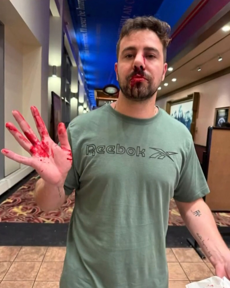 A man with blood on his face and hand.