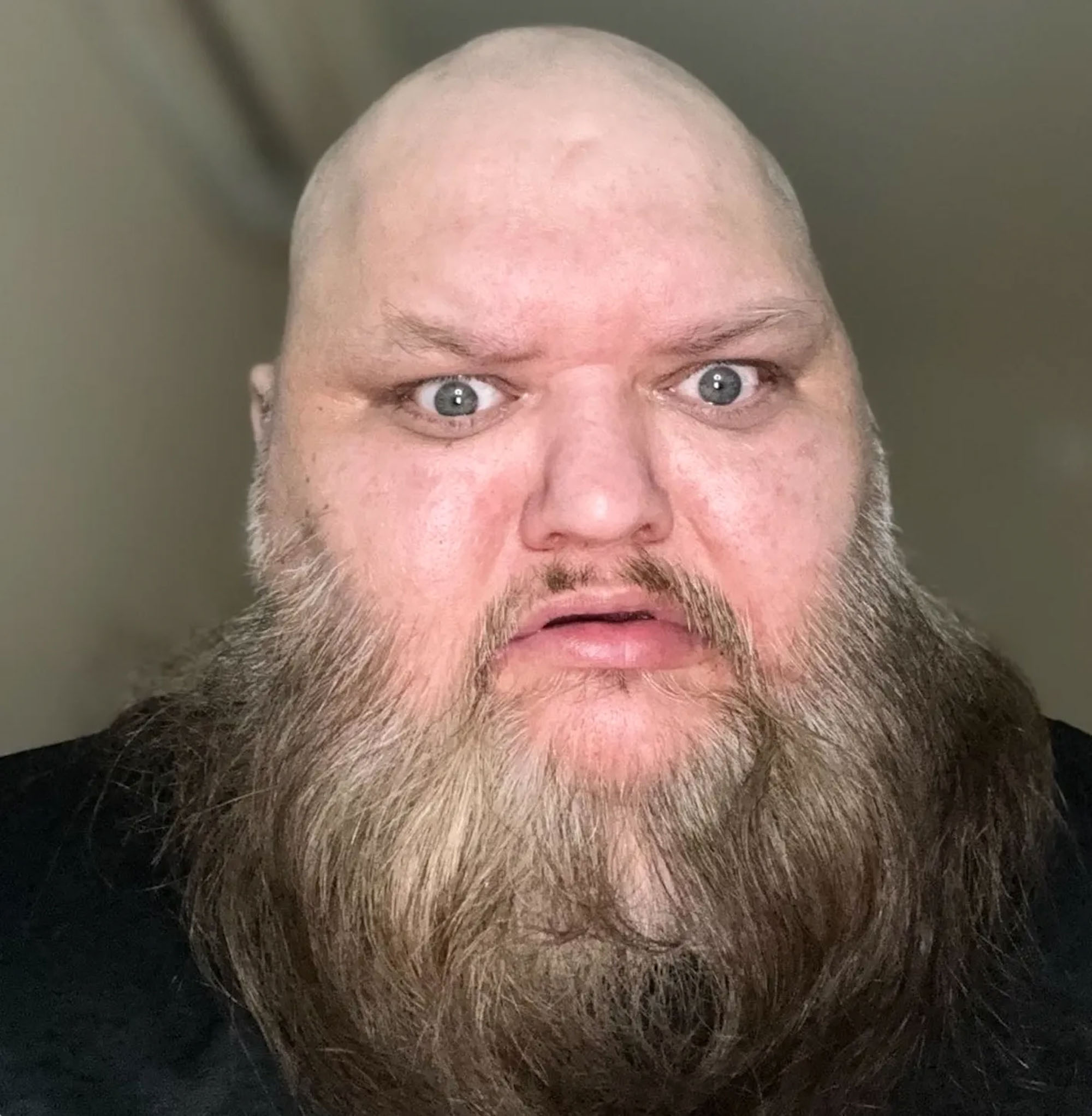 John Crawley, KingBeardX, looks surprised. 