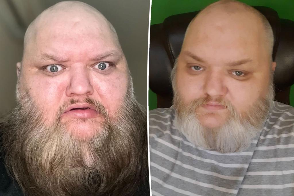 TikTok star John Crawley, known as ‘KingBeardX,’ dead at 47