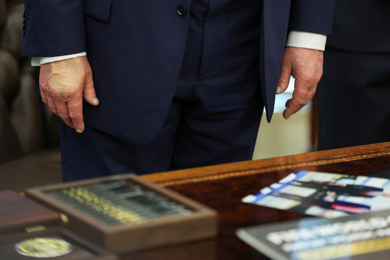 Make-up covers the back of the right hand of President Donald Trump in the Oval Office at the White House in Washington, D.C., U.S., August 22, 2025.