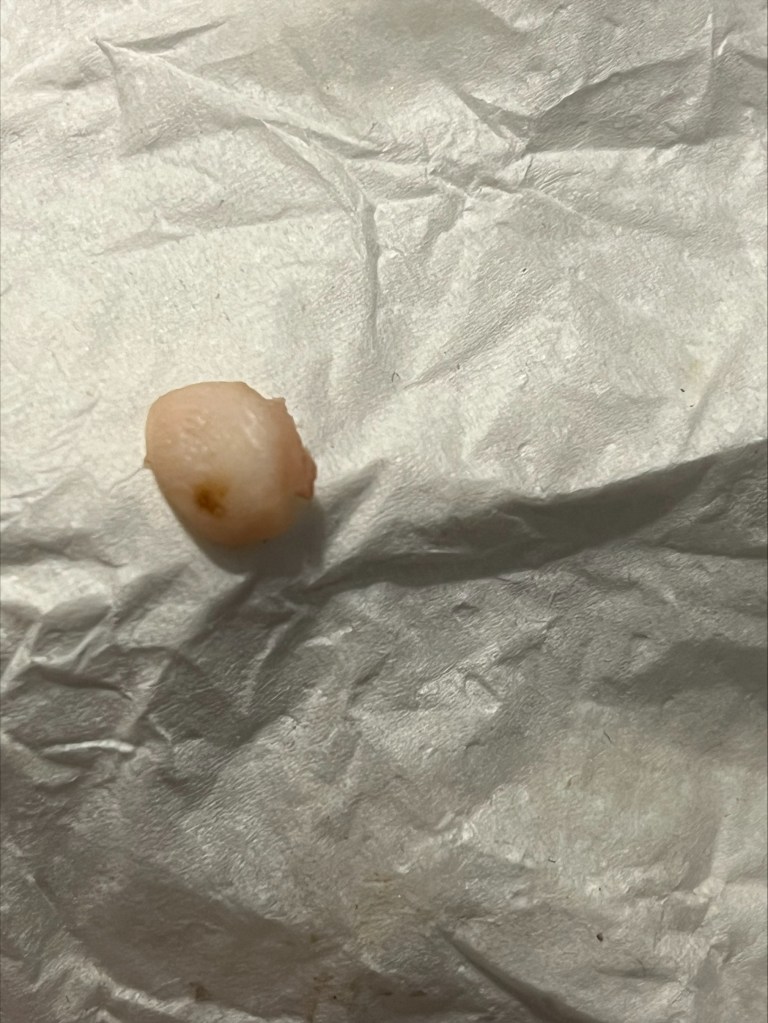 A piece of finger found in a chicken wrap.