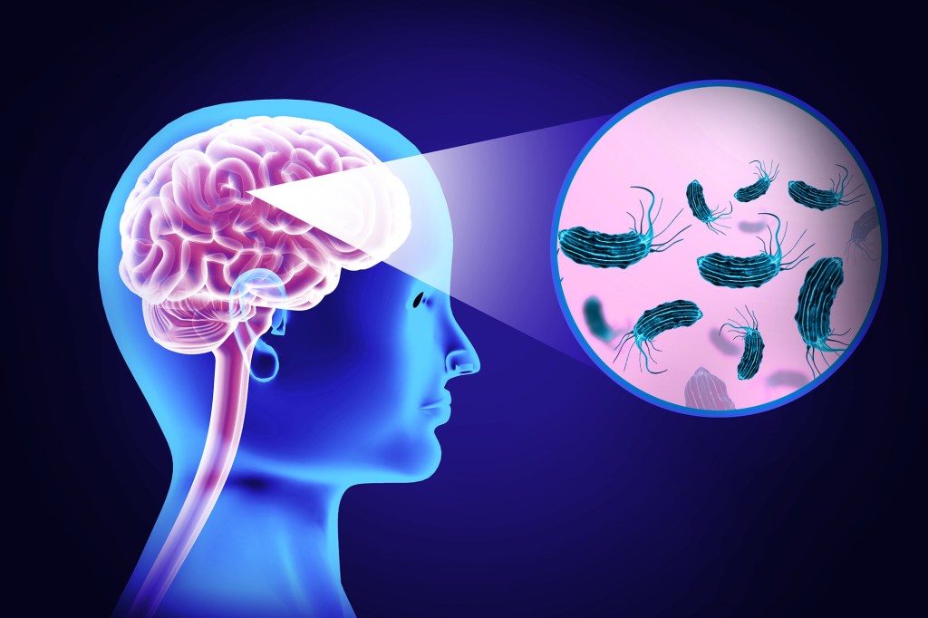 Illustration of brain-eating amoeba infection.
