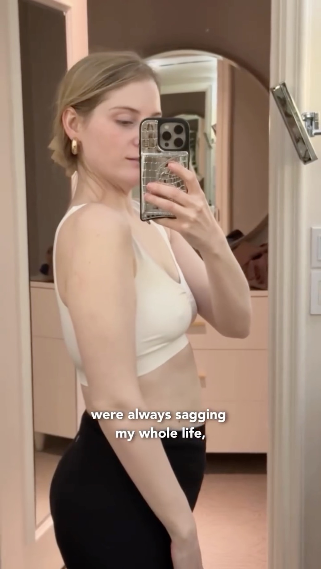 Meghan Trainor before her boob job