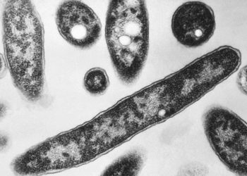 4th person dies after a Legionnaires’ disease outbreak sickens dozens in New York City