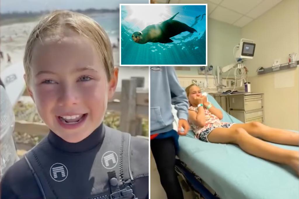 9-year-old girl bitten by sea lion in rare attack while at surf camp: ‘I was like, Oh my gosh … and it just bit me’