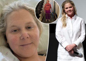 Amy Schumer poses with a walker, reveals she underwent spinal surgery