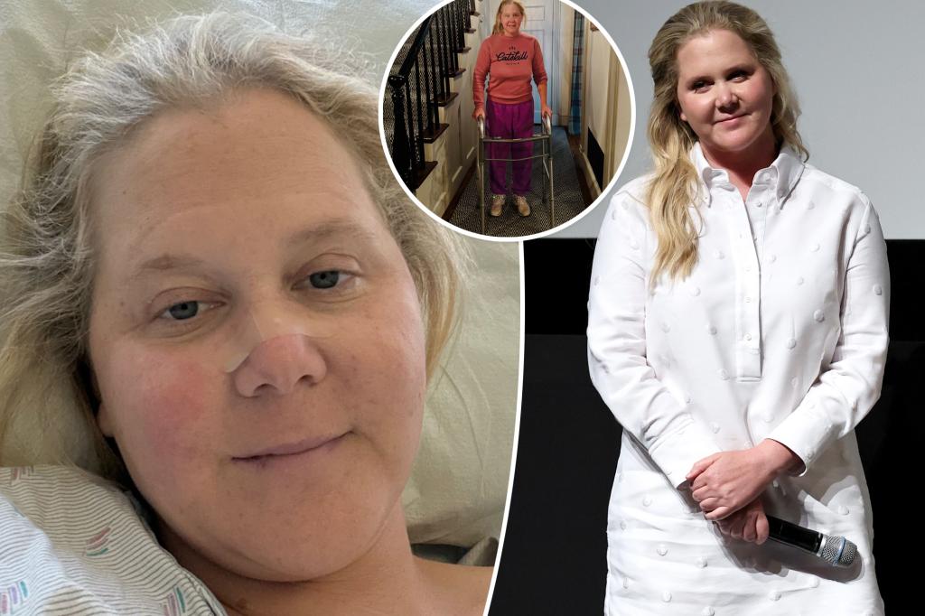 Amy Schumer poses with a walker, reveals she underwent spinal surgery