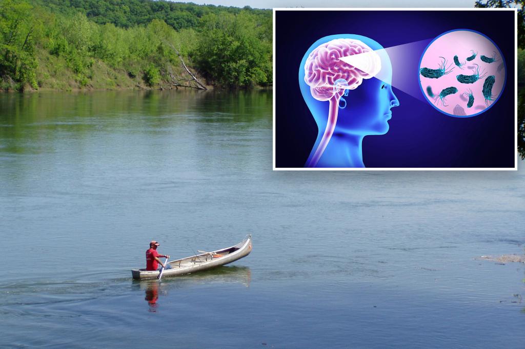 Brain-eating amoeba kills Missouri patient at St. Louis hospital