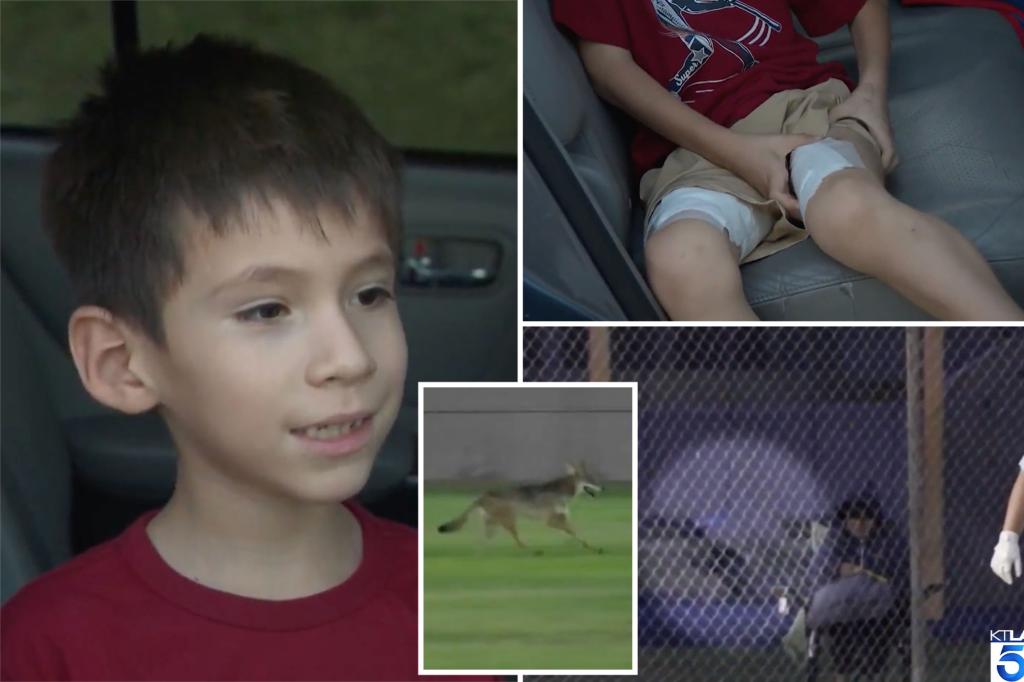 Coyote attacks little boy at Southern California softball game