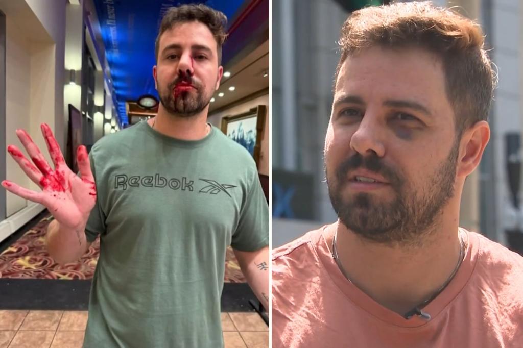 Furious Harvard researcher claims he was pummeled by group of teens after he told them to be quiet in movie theater: ‘They just punched me’