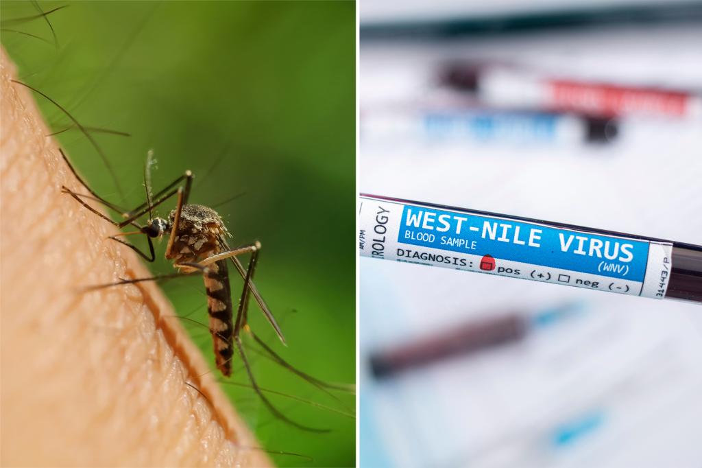 Health officials confirm human case of West Nile virus transmitted by mosquitoes in New Orleans