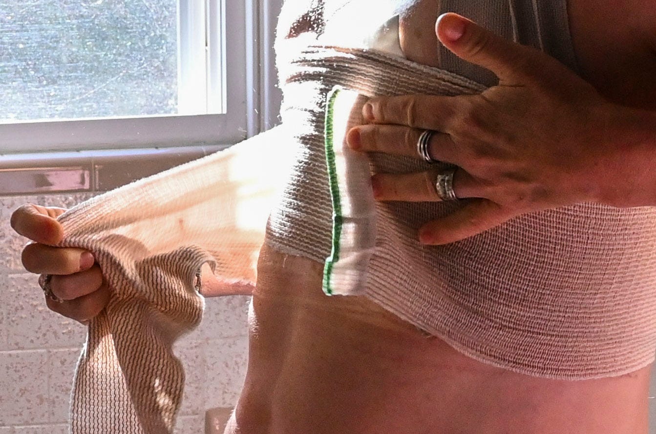 The woman removes the bandages covering her surgery