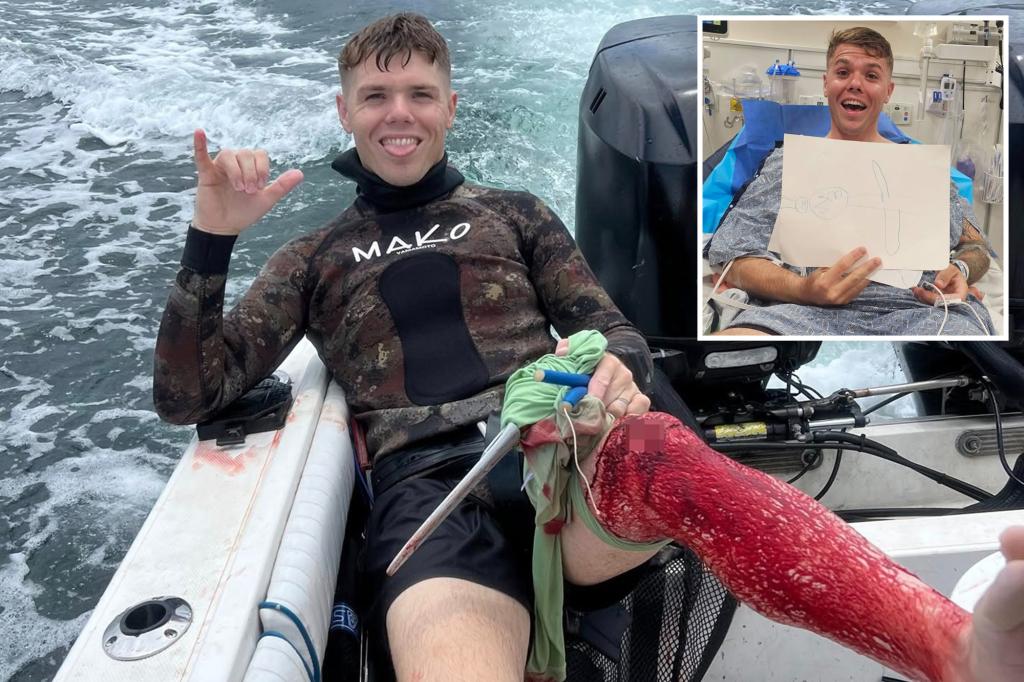 Incredible photo shows fisherman smiling while covered in blood from ‘gnarly’ shark attack