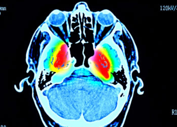 Japan’s Pharma Leader Is Seeking Approval for a New Parkinson’s Treatment