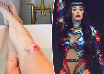 Katy Perry shows off brutally scraped knees she sustained during her ‘Lifetimes’ tour