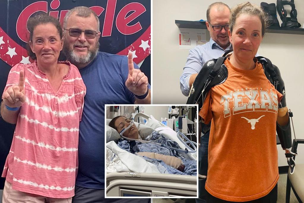 Medicaid denies prosthetics for Texas woman who lost both arms in vicious 2023 dog attack