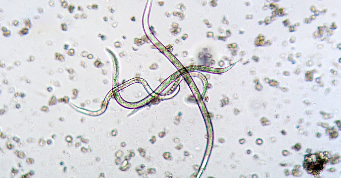 This Man’s Blurry Vision Turned Out To Be Worms Swimming in His Eyeball