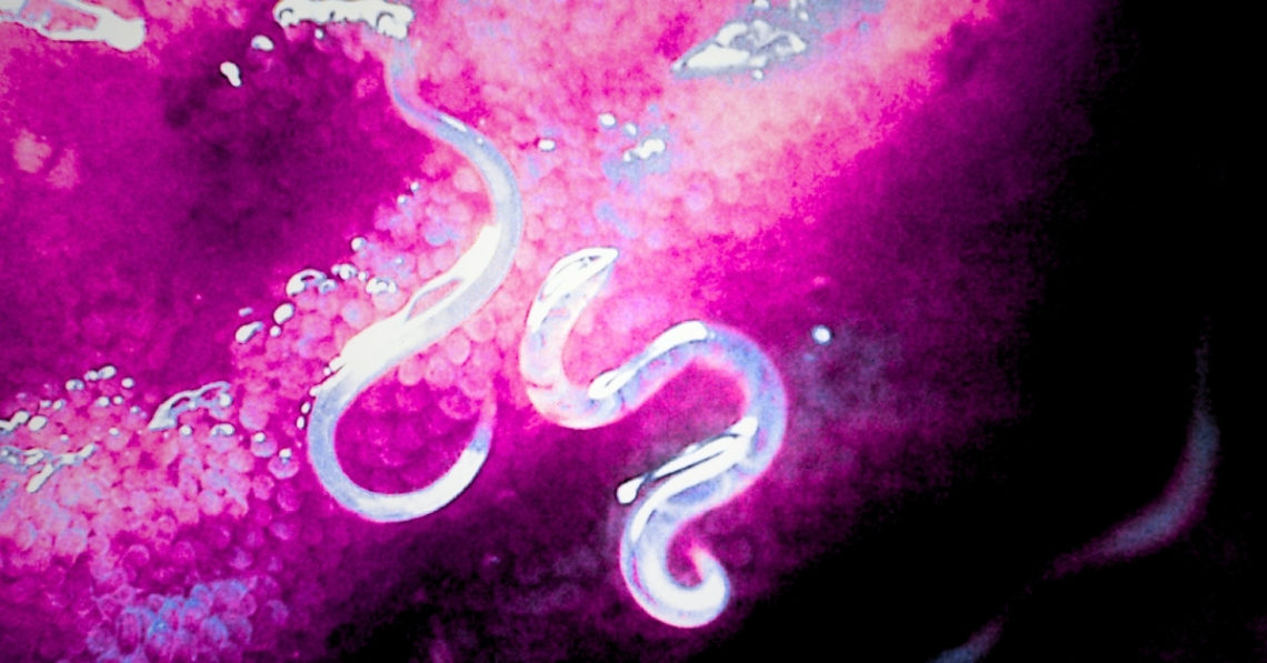 This Parasitic Worm Might Be the Future of Painkillers