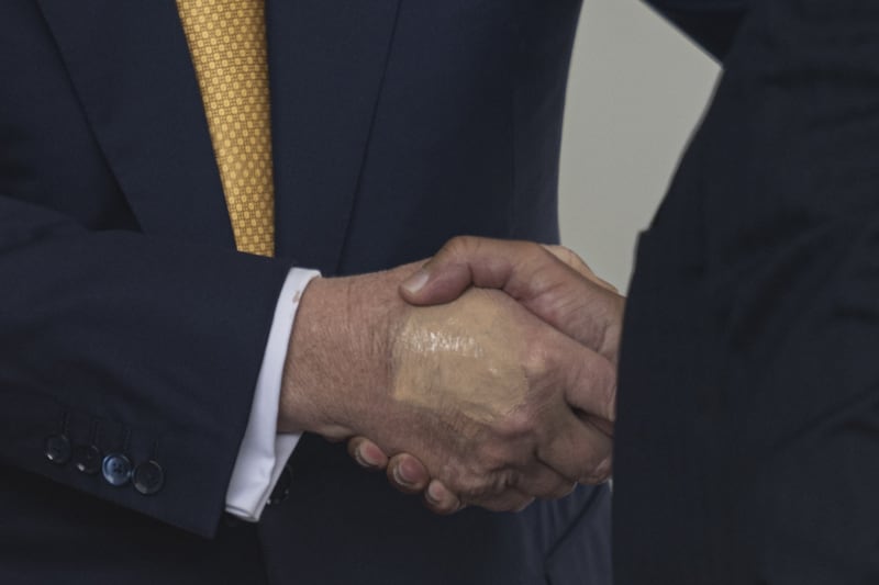 A bruise is seen on President Trump's right hand which is covered over with make-up.