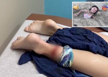 Shark bites 8-year-old girl in grisly Texas beach attack: ‘It was just so much blood’