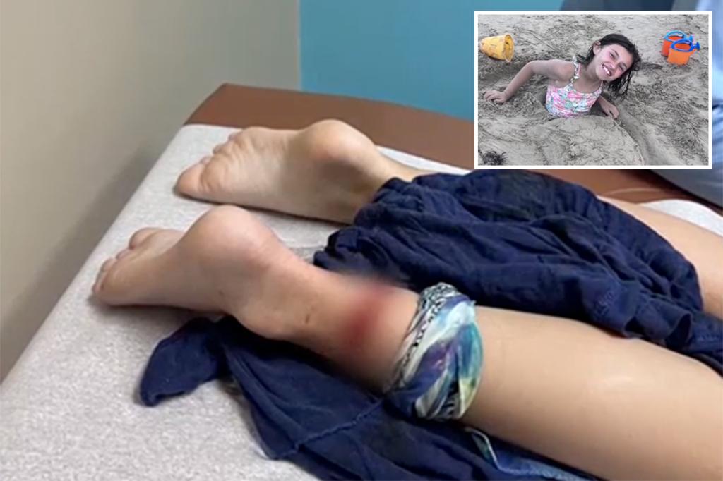 Shark bites 8-year-old girl in grisly Texas beach attack: ‘It was just so much blood’