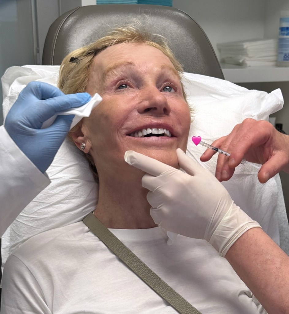 Barbara Corcoran getting injections selfie