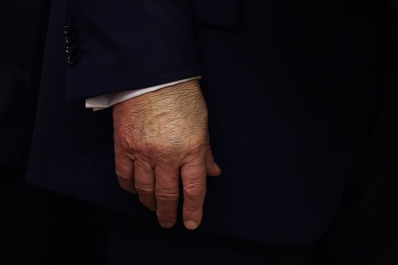 A detailed view of the hand President Donald Trump's hand covered in makeup on September 2.