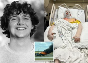 Texas college student, 19, suffers ‘catastrophic, life-changing’ burns after being struck by alleged drunk driver