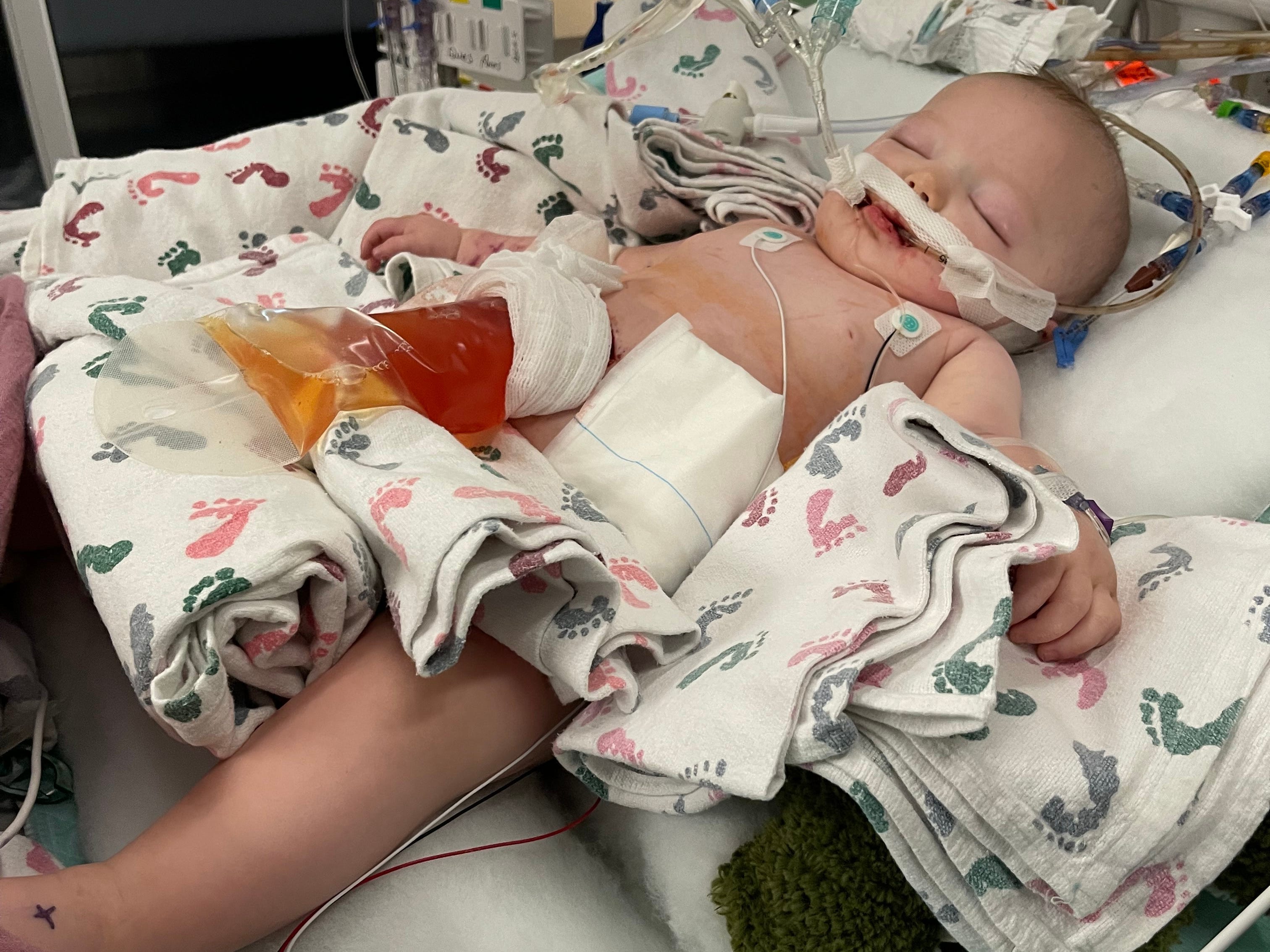 A baby in a hospital surrounded by medical equipment