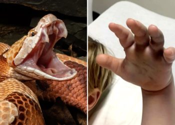 Boy, 4, bitten by snake at day care as family learns staff never called 911: reports