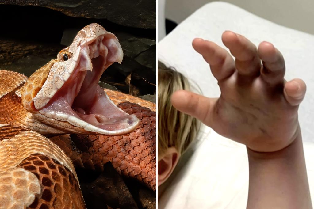 Boy, 4, bitten by snake at day care as family learns staff never called 911: reports