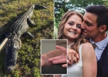 Florida optometrist mauled by 8-foot gator that clamped onto her arm in harrowing tug of war with ‘hero’ husband