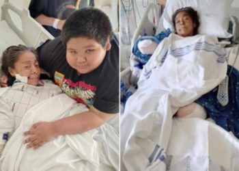 Oklahoma woman loses both arms and legs in vicious dog attack