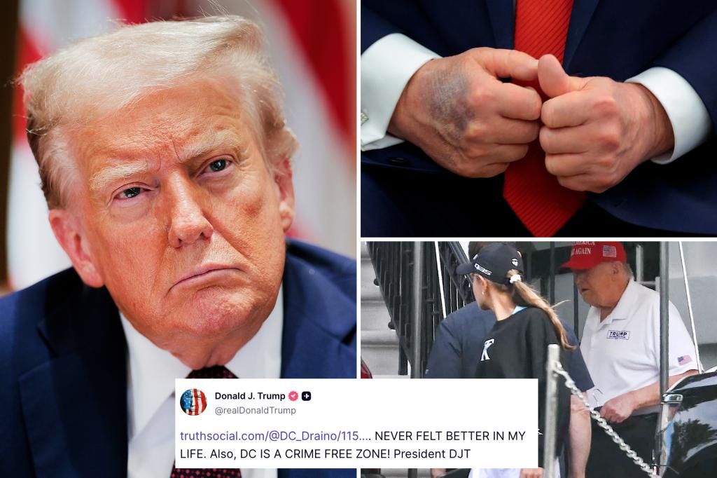 Trump defiantly addresses health speculation with Truth Social response