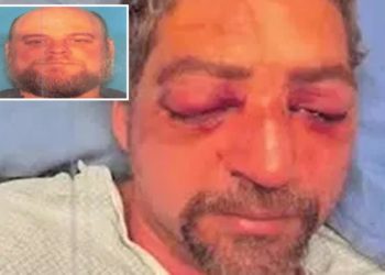 Vermont husband almost permanently blinded after road rage maniac gouged his eyes during brutal assault