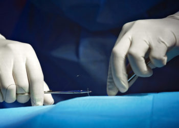 Women Are Now Getting Limb-Shortening Surgery in the Name of Love