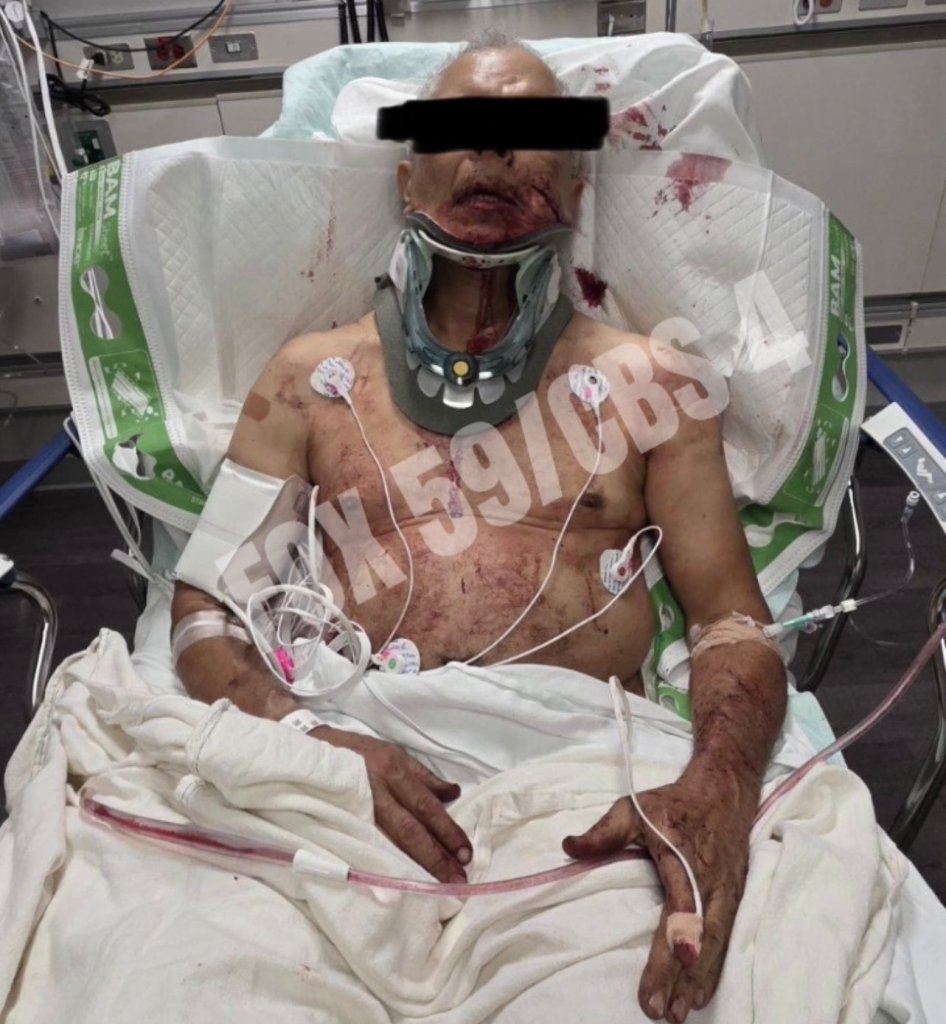 Injured man with a neck brace and bloodied chest, arm, and face.