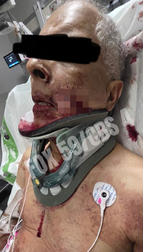 An unidentified person involved with teh stabbing of former quarterback Mark Sanchez 